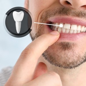 A man showing which of his teeth is a dental implant