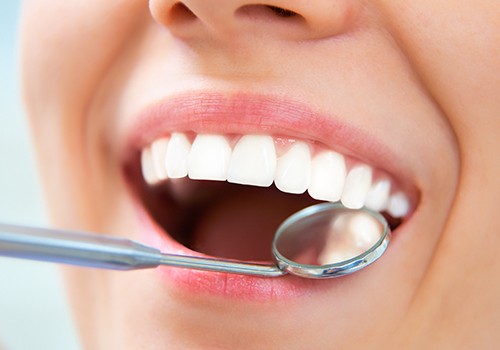 Closeup of smile with tooth-colored fillings