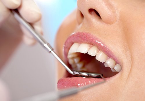 Closeup of patient's smile during dental checkup