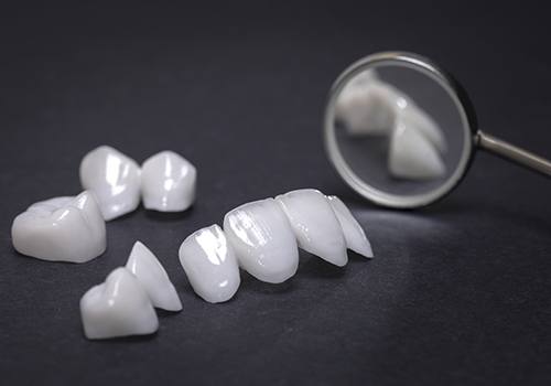 Metal free dental restorations prior to placement