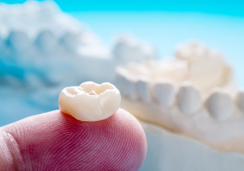 A single dental crown 