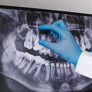 dentist looking at X-ray