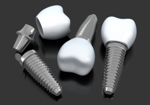 Three animated dental implant supported replacement teeth