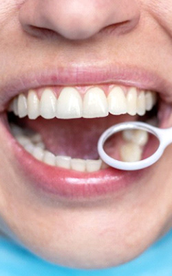 Dentist examining a patient’s mouth with dental mirror