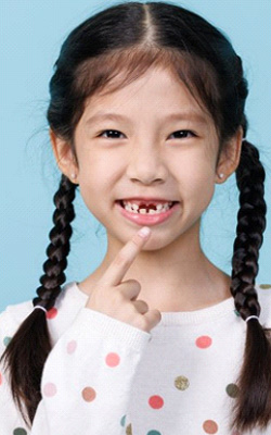 Child with two missing front teeth smiling