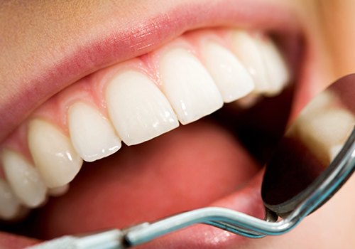 Patient's healthy smile after fluoride treatment