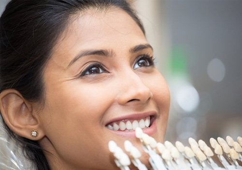 Woman’s smile being matched to a shade guide